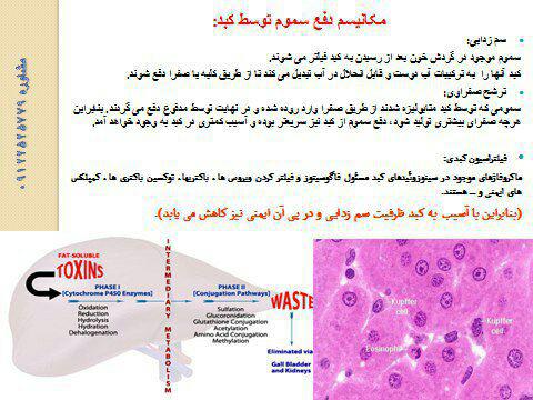 سندرم کبد چرب طیور